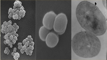 Left: Scanning electron micrograph of Micrococcus luteus, low power. Center: Higher magnification of a single tetrad. Right: A high magnification transmission electron micrograph