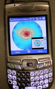 The image on the above phone's screen is a simulated breast tumor, shown in red. (Photo courtesy of (Photo courtesy of Boris Rubinsky, UC Berkeley)