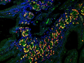 Fluorescence microscopy section of the intestine. Green/yellow areas mark sites of cell proliferation. Cell nuclei marked in blue and nuclei with DNA replication marked in red. (Photo: Agnes Klochendler)