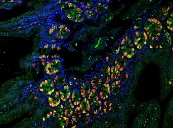 Fluorescence microscopy section of the intestine. Green/yellow areas mark sites of cell proliferation. Cell nuclei marked in blue and nuclei with DNA replication marked in red.  (Photo: Agnes Klochendler) 